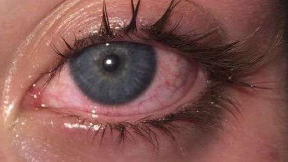 Bloodshot Eyes-Eyelashes-Eyelash Extensiosn